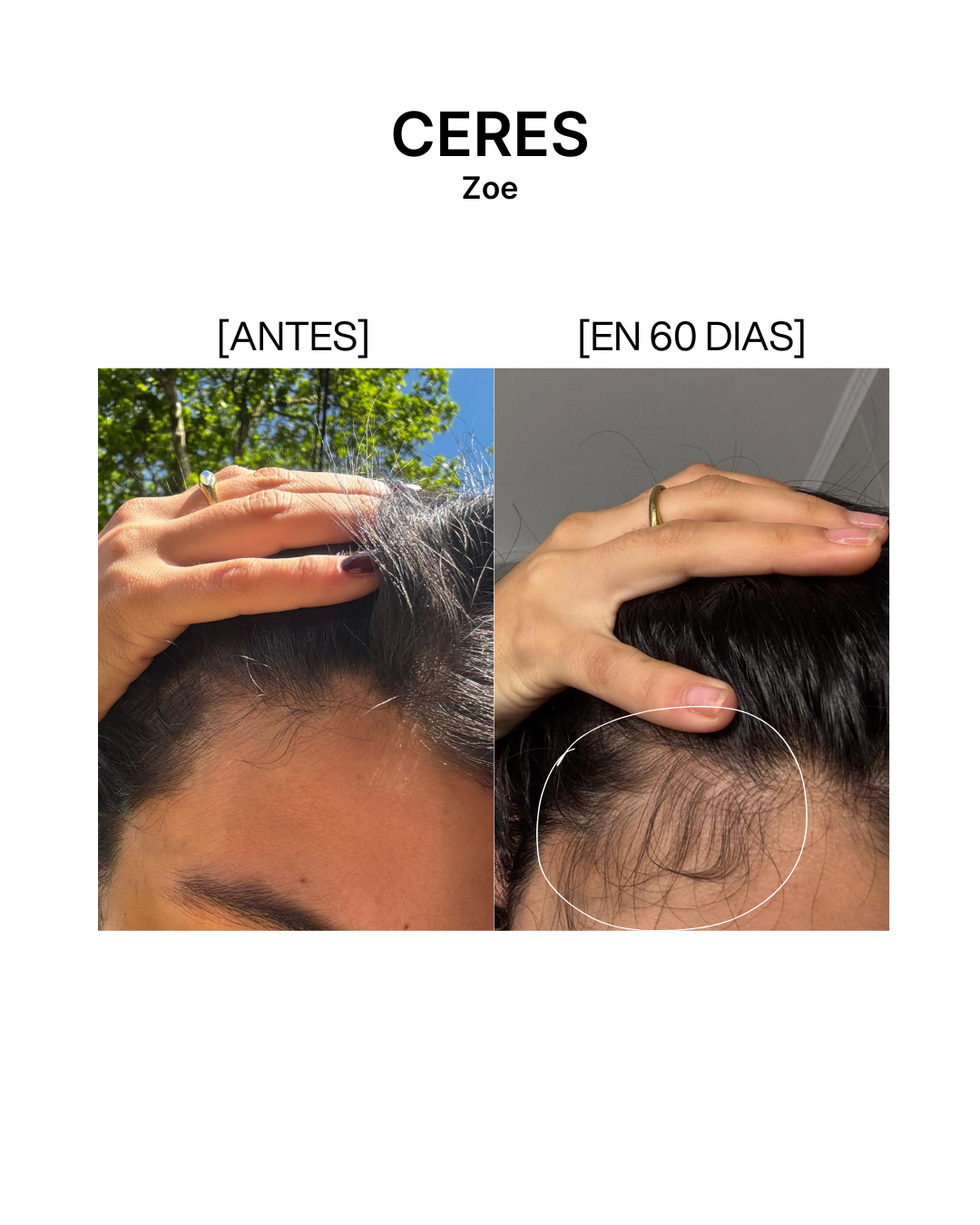 Pack x3 anticaída