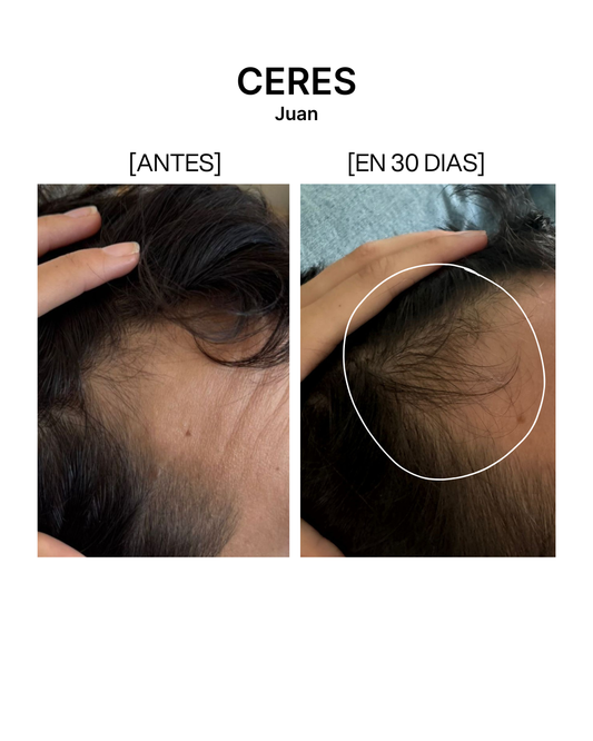 CERES Tónico anticaída [100ml]